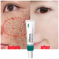 Salicylic Acid Pore Shrinking Cream Remove Acne Pores Oil Control Facial Tightening Repairing Serum Moisturizing Skin Care