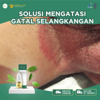 Propolis SM Gatal Selangkangan, Selangkangan Berjamur, Selangkangan Paha Gatal, Selangkangan Hitam D