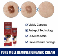 Wart Removal Acne, Krim Penghilang Tahi Lalat & Ketuat untuk badan - Serum, Tidak Sakit, untuk Tahi