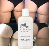 Private Label Special Buttock Relieve Itching Acne Treatment Cream Butt Acne Clearing Lotion for Body, Back, Bum, &amp; Thigh