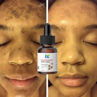 Whitening Serum Fade Dark Spot Freckle Brighten Essence Remove Pigment Melanin Correcting Beauty Face Skin Care