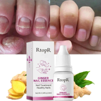 RtopR Nail Lotion Repair Rough Nails Promote Nail Growth A5Y2