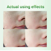 Salicylic Acid Pores Shrinking Cream Repair Large Pore Minimizer Moisturizer Blackhead Acne Marks Removal Facial Skin Care 20g