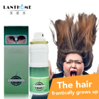 Lanthome Pilatory Extra Strength Serum For Fast Hair Growth Spray Sunburst Alopecia Areata Anti Baldness Hair Loss Treatment O