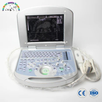 12 Inch LCD Display screen Portable Notebook Ultrasound 96 Element Equipped with Linear Convex Microconvex Probe