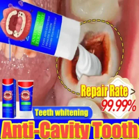 Teeth Whitening Anti-cavity Toothpaste Removal Tooth Stains Fresh Breath Tooth Care New 2024
