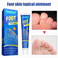 Sumifun Kulat air Kaki gatal berbau Foot fungus beriberi itching infection Inhibit foot odor Repairi