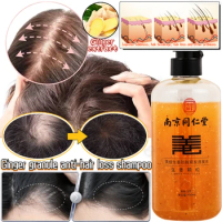Ginger Plant Extract Anti-hair Loss Shampoo Anti-hair Loss Shampoo Hair Growth Nourishing Hair Follicle Repair Shampoo 400ml