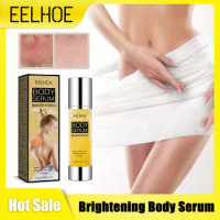 Brightening Body Serum Improve Skin Tone Anti Dark Spots Melanin Pigment Removal Whitening Lightening Nourish Skin Essence 100ml
