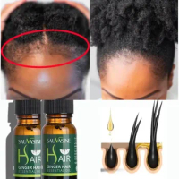 Ginger Black Seed Castor Oil Hair Growth Serum, Thick Hair, Fast Growth Herbal Hair Oil loss Growth thicker Fuller hair