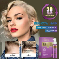 Hair Growth Essence Oil Spray Fast Hair Growth Natural Anti Hair Loss Treatment Hair Solution Hair Care Products Hair Tonic