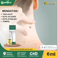 Propolis SM Untuk Penghilang tahi lalat, tahi lalat di wajah, Salep tahi lalat, Penghilang tahi lala