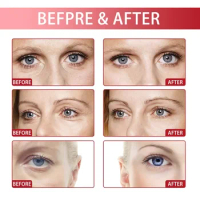 Sdottor Vitamin C Eye Mask Moisturizing reduce fine lines Improve Dark Circle Eye bag Anti Aging lifting firming skin care Eye