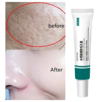 Salicylic Acid Pore Shrinking Cream Large Pores Tightening Repairing Serum Moisturizing Oil Control Skin Care Korean Cosmetic