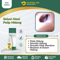 Obat Polip Hidung Anak dan Dewasa, Sinusitis Pilek Menahun, Sinus, Hidung Bau Busuk - Propolis SM
