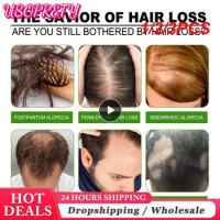 1/2/3PCS 10/30ml Hair Growth Spray Fast Grow Hair Oil Hair Loss Cure for Thinning Hair Growth Spray Products Hair Care for Women