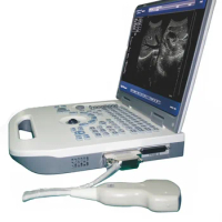 JT-S50A Portable Notebook Digital Ultrasound Scanner Black And White Diagnosis Equipment