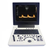 Digital Mobile Notebook Medical Ultrasound Diagnostic System Portable 3D 4D CW Color Doppler Ultrasound Laptop Scanner Machine