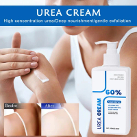 Kem dưỡng thể Viareline tẩy tế bào chết với urea, phục hồi sâu – kem dưỡng ẩm intensives, chứa axit 