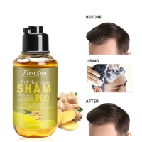 100ml ginger shampoo Anti-hair loss repair dry hair Gentle does not hurt scalp Regulate oil secretion Improve scalp condition