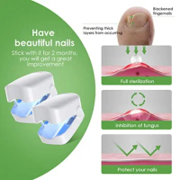 Nail Fungus Treatment Tools Fungal Nail Treatment Anti-Equipment Effectively Remove Fungal Toenail Nail Fungal Infection