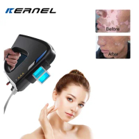 Kernel KN-5000C Portable Medical Equipment High Intensity eczema treatment device 308nm excimer vitiligo treatment