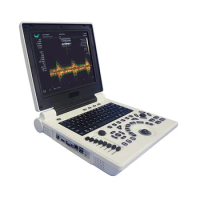 P20 Notebook Forward Cheapest Machine Portable Baby Ultrasound Scanner