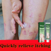 Psoriasis Cream Antifungal cream ubat gatal kulit tiger balm Itchy Skin Eczema cream Anti-itch cream