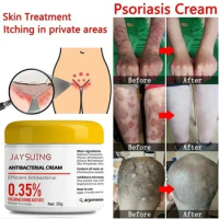 Psoriasis Moisturizing Cream Natural Repair Antibacterial Relieve Exfoliate Dry Skin Itchy Rough Ski