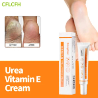 Anti Crack Foot Cream Urea Vitamin E Drying Cracked Feet Repair Hand Heel Dead Skin Removal Moisturizing Care Foot Mask