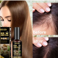Protect hair. Anti hair loss spray anti hair loss hair nutrition growth agent essence promotes hair growth