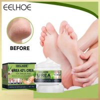 EELHOE Hand Feet Care Cream Anti-Drying Crack Foot Cream Heel Cracked Repair Cream Removal Dead Skin Hand Feet Care Foot Mask