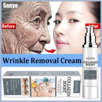 EELHOE New Collagen Anti-wrinkle Whitening Cream Moisturizing Anti-aging Essence Nourishing Skin Care Dark Spot Remover Cream