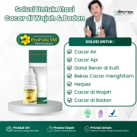 Propolis SM Untuk Atasi Cacar Air Cacar Api Cacar Monyet Herpes Gatal Berair Penghilang Bekas Cacar 