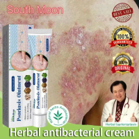 Special cream, psoriasis cream – imported – for scalp itching, dandruff, body itching, itching, skin