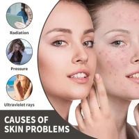 Sdottor Dark Spot Acne Essence fade Spots Moisturizes Anti-freckle Skin Repair Acne Prints Facial Dull Brightening whitening ser