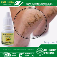 Cairan Oles Untuk Kaki Pecah Pecah, Tumit Kaki Kering Pecah Pecah, Menghaluskan dan Melembutkan Tumi