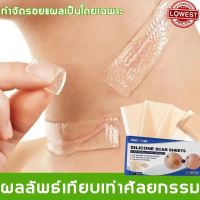 South Moon แผ่นแปะซิลิโคน แผ่นแปะคีลอยด์ ซิลิโคนยากำจัดแผลเป็น แผ่นแปะซิลิโคนเจล แผ่นแปะรอยแผลเป็นนู