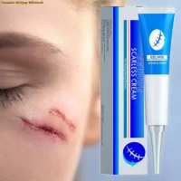 Scar Removing Gel With Effective Function Healthy And Safe Waterproof Scar Removing Gel Non Greasy Easy To Use For Face Care