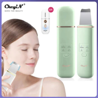 CkeyiN Ultrasonic Skin Scrubber EMS Ion Import Facial Lifting Vibration Massager Deep Face Pore Cleansing Blackhead Remover Tool