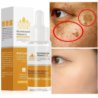 Whitening Freckle Serum Nicotinamide Remove Melasma Dark Spots Fade Pigment Melanin Correcting Brighten Facial Beauty Skin Care