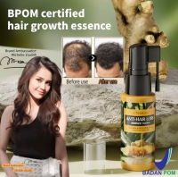 BPOM CERTIFIED Kormesic ANTI HAIR LOSS ESSENCE WATER JAHE KOREAN SKINCARE COSMETICS COSMETIC KOREA K