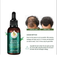 Ginger Hair Growth Spray Strengthening-Hair Massage Scalp Dense-Hair Strengthening Hair Loss Prevention Repair Nourishing Liquid
