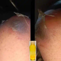 Yellow peeling oil extra strength Treatment for Bleaching Face Body Lightening oil Underarm Whitening Legs Whitening Parts Knees