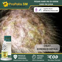 Salep Oles Koreng Herbal, Koreng di kepala, Luka Koreng di Kulit Kepala, Oles Koreng di Kepala, Sale