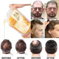 500ml Pure Ginger Black Hair Growth Anti-Hair Loss Shampoo Ginger Juice Shampoo Fresh Squeezed Moisturize Scalp Hair Care
