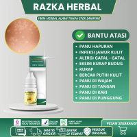 Propolis SM Cair Atasi Panu Wajah Parah, Panu Kadas Kurap, Panu Hitam, Panu Di Badan, Gatal Panu Sel